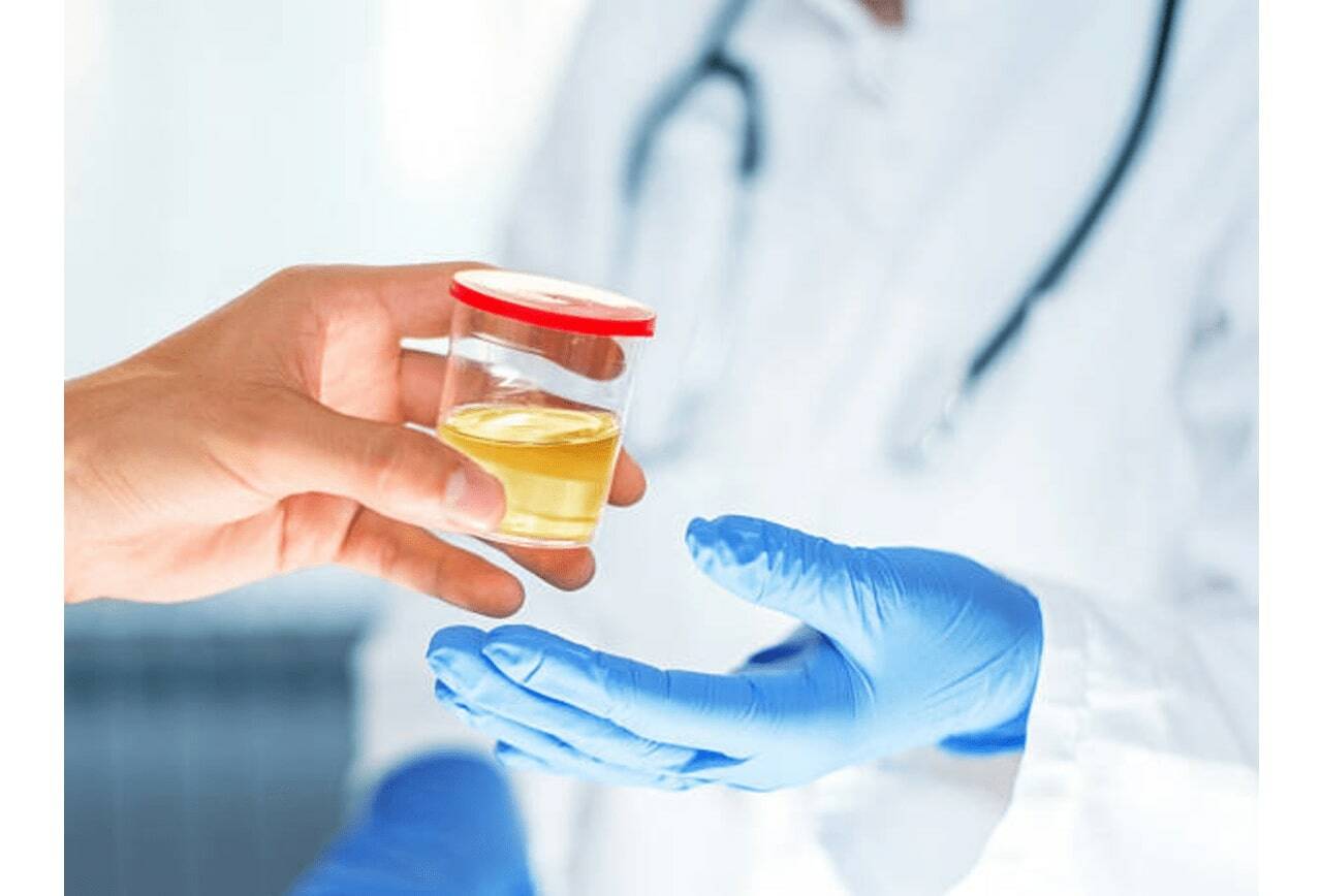 Best Synthetic Urine Kits: Top 5 Brands Of Fake Pee To Pass A Drug Test In  2023 | Tacoma Daily Index