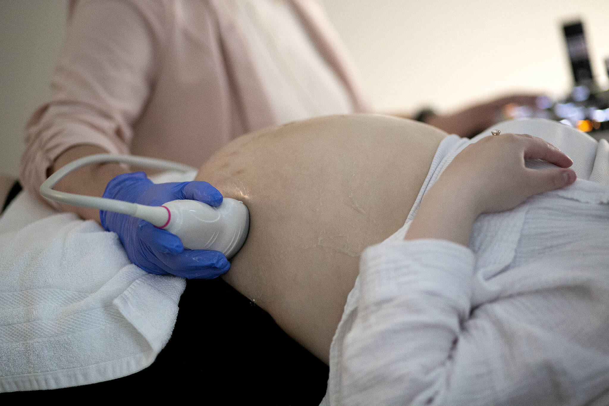 Sound Publishing file photo
An ultrasound being performed on an expecting mother in 2023 in Everett.