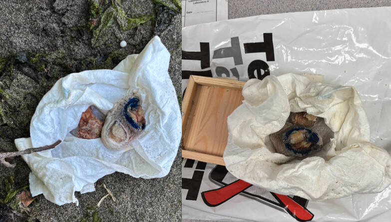 Different angles of the toe found on the beach. From WSP records request.